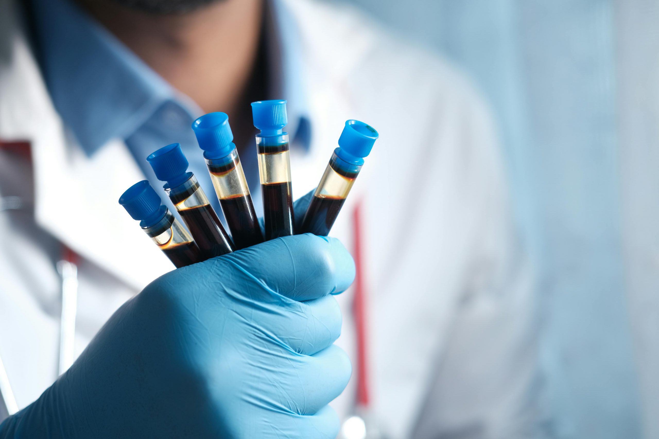 ¿Por qué los servicios de toma de muestra médica son gravados con IVA?